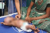 Bí ẩn của gia đình có 2 bé trai tự bốc cháy Bí ẩn của gia đình có 2 bé trai tự bốc cháy