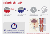 Cách điều trị thiếu máu não hiệu quả Cách điều trị thiếu máu não hiệu quả