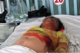 Ghen tuông, nam thanh niên dùng xăng đốt “vợ hờ” Ghen tuông, nam thanh niên dùng xăng đốt “vợ hờ”