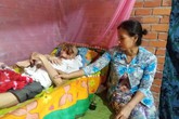 Bi kịch người đàn ông bị căn bệnh lạ “ăn” mất khuôn mặt Bi kịch người đàn ông bị căn bệnh lạ “ăn” mất khuôn mặt