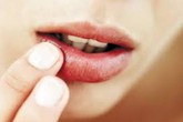 Đẩy lùi nhiệt miệng Đẩy lùi nhiệt miệng
