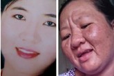 Thai phụ mang họa vì tự ý dùng thuốc dị ứng Thai phụ mang họa vì tự ý dùng thuốc dị ứng