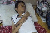 Cậu bé 15 năm giành giật… sự sống Cậu bé 15 năm giành giật… sự sống