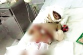 Con gái phải cắt bỏ hai chân vì cha mẹ cãi nhau Con gái phải cắt bỏ hai chân vì cha mẹ cãi nhau