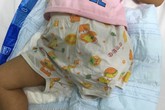 Bé gái phải cưa cụt chân do người lớn bất cẩn Bé gái phải cưa cụt chân do người lớn bất cẩn