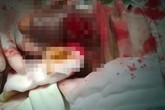 “Gãy súng” đêm giao thừa “Gãy súng” đêm giao thừa