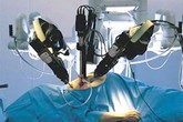 Bệnh nhân nhẹ cân nhất được thực hiện mổ nội soi bằng rô-bốt Bệnh nhân nhẹ cân nhất được thực hiện mổ nội soi bằng rô-bốt