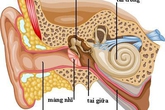 Nguy cơ suy giảm thính lực do viêm tai giữa Nguy cơ suy giảm thính lực do viêm tai giữa