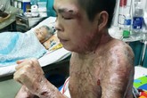 Ngoạn mục cuộc "hô biến" người lật đật thành người bình thường Ngoạn mục cuộc "hô biến" người lật đật thành người bình thường