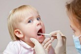 Chữa nhiệt miệng cho trẻ tại nhà Chữa nhiệt miệng cho trẻ tại nhà