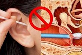 Sau khi xem bức hình này, đảm bảo bạn sẽ không dám ngoáy tai nữa Sau khi xem bức hình này, đảm bảo bạn sẽ không dám ngoáy tai nữa