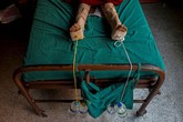 Hàng nghìn người sống sót động đất Nepal có thể tàn tật suốt đời Hàng nghìn người sống sót động đất Nepal có thể tàn tật suốt đời