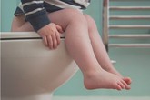 Bé đại tiện ra máu có thành bệnh trĩ? Bé đại tiện ra máu có thành bệnh trĩ?