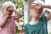 Ký ức hãi hùng của hai đứa trẻ bị nghi là “ma cà rồng” Ký ức hãi hùng của hai đứa trẻ bị nghi là “ma cà rồng”