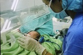 Một bé sơ sinh bị ruột nằm ngoài da hiếm gặp Một bé sơ sinh bị ruột nằm ngoài da hiếm gặp