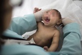 Trẻ đầu nhỏ và Zika Trẻ đầu nhỏ và Zika