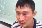 "Đại gia" quỵt 30 ngàn tiền giao hàng và đánh shipper gãy mũi "Đại gia" quỵt 30 ngàn tiền giao hàng và đánh shipper gãy mũi