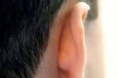 5 vị trí không ngờ có thể bị ung thư da 5 vị trí không ngờ có thể bị ung thư da