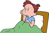 Những sai lầm hay gặp khi trẻ bị thủy đậu Những sai lầm hay gặp khi trẻ bị thủy đậu