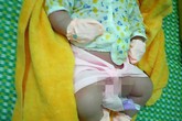 Bé trai sơ sinh có cân nặng "khủng" 5,1kg Bé trai sơ sinh có cân nặng "khủng" 5,1kg