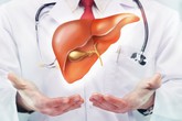 Những “sát thủ” thầm lặng gây bệnh gan có thể bạn mắc mà không biết Những “sát thủ” thầm lặng gây bệnh gan có thể bạn mắc mà không biết