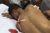 Bị ném đá thủng mái nhà, sang hỏi hàng xóm thì suýt mất mạng Bị ném đá thủng mái nhà, sang hỏi hàng xóm thì suýt mất mạng