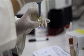 Người dân không nên tự xét nghiệm virus Zika Người dân không nên tự xét nghiệm virus Zika