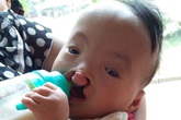 Xót thương cháu bé 10 tháng tuổi mắc 3 bệnh hiểm nghèo Xót thương cháu bé 10 tháng tuổi mắc 3 bệnh hiểm nghèo