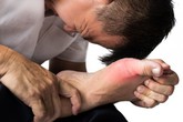 Bệnh gút ăn gì để giảm đau? Bệnh gút ăn gì để giảm đau?