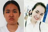 Những cô gái đổi đời nhờ thẩm mỹ giờ ra sao (2): "Vịt con xấu xí” thành bản sao Lý Nhã Kỳ Những cô gái đổi đời nhờ thẩm mỹ giờ ra sao (2): "Vịt con xấu xí” thành bản sao Lý Nhã Kỳ