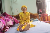 Kỳ lạ cụ ông 104 tuổi "bàn chân Giao Chỉ" cả đời không đi vừa đôi dép nào Kỳ lạ cụ ông 104 tuổi "bàn chân Giao Chỉ" cả đời không đi vừa đôi dép nào