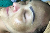 Cẩn trọng với kem ốc sên làm trắng da siêu tốc Cẩn trọng với kem ốc sên làm trắng da siêu tốc