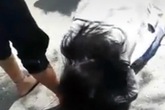 Nữ sinh Sài Gòn bị đánh hội đồng, châm thuốc vào tay Nữ sinh Sài Gòn bị đánh hội đồng, châm thuốc vào tay