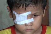 Khát khao đến trường của cậu bé bị ung thư mắt Khát khao đến trường của cậu bé bị ung thư mắt