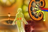 Những thói quen dễ gây hỏng thận Những thói quen dễ gây hỏng thận