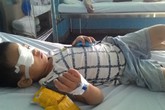 Bé trai hỏng mắt do bị bạn ném đá Bé trai hỏng mắt do bị bạn ném đá