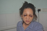 Giây phút kinh hãi của cô gái bị bạn trai là thiếu uý công an đánh chấn thương sọ não Giây phút kinh hãi của cô gái bị bạn trai là thiếu uý công an đánh chấn thương sọ não