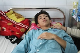 Học sinh lớp 9 bị nhóm bạn đánh chấn thương sọ não Học sinh lớp 9 bị nhóm bạn đánh chấn thương sọ não