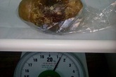 Hy hữu viên sỏi bàng quang nặng 1,5kg Hy hữu viên sỏi bàng quang nặng 1,5kg