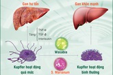 Cách bảo vệ gan trước nguy cơ thực phẩm bẩn Cách bảo vệ gan trước nguy cơ thực phẩm bẩn