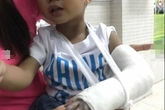 Giáo viên mầm non đập bàn "vô tình" làm gãy tay bé trai 3 tuổi Giáo viên mầm non đập bàn "vô tình" làm gãy tay bé trai 3 tuổi