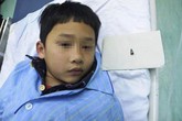 Bé trai 7 tuổi nuốt đầu bút bi, mắc kẹt trong phế quản Bé trai 7 tuổi nuốt đầu bút bi, mắc kẹt trong phế quản