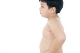 Trẻ 3 tuổi nặng gần 18 kg làm sao giảm cân Trẻ 3 tuổi nặng gần 18 kg làm sao giảm cân