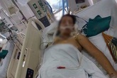 Cô giáo trẻ bị xe chèn ngang người được mổ cứu con Cô giáo trẻ bị xe chèn ngang người được mổ cứu con