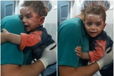 Đau lòng trước hình ảnh cậu bé Syria người đầy máu tuyệt vọng ôm chặt lấy y tá Đau lòng trước hình ảnh cậu bé Syria người đầy máu tuyệt vọng ôm chặt lấy y tá