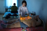 Cậu bé béo phì bị đốt để giảm cân Cậu bé béo phì bị đốt để giảm cân