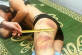 Nỗi đau dấu kín của nhiều phụ nữ khi phải cắn răng "chiều chồng" Nỗi đau dấu kín của nhiều phụ nữ khi phải cắn răng "chiều chồng"