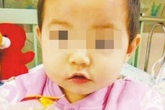 Bé gái 2 tuổi suýt mất mạng vì nghịch đũa khi đang ăn cơm Bé gái 2 tuổi suýt mất mạng vì nghịch đũa khi đang ăn cơm