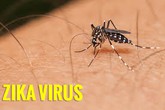Tập huấn cập nhật siêu âm chẩn đoán và theo dõi tật đầu nhỏ ở thai nhi do Zika Tập huấn cập nhật siêu âm chẩn đoán và theo dõi tật đầu nhỏ ở thai nhi do Zika