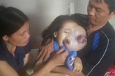 Bủn rủn khi nhìn gương mặt của bé gái 5 tuổi bị ung thư võng mạc Bủn rủn khi nhìn gương mặt của bé gái 5 tuổi bị ung thư võng mạc